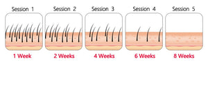 IPL Laser Hair Remover