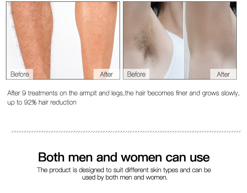 IPL Laser Hair Remover